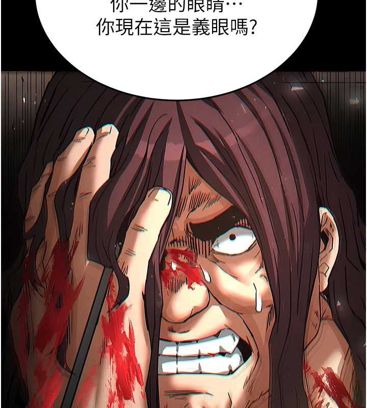 末日鵰堡，第47話-這可是活生生移植的眼睛，第 159 页